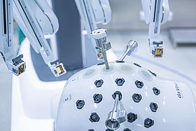 Das Bild zeigt die Arme des da Vinci im Detail