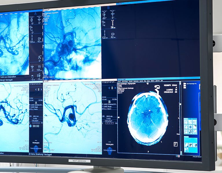 Das Bild zeigt eine Angiografie von Gefäßen