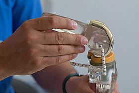 Das Bild zeigt das Modell eines Kniegelenks