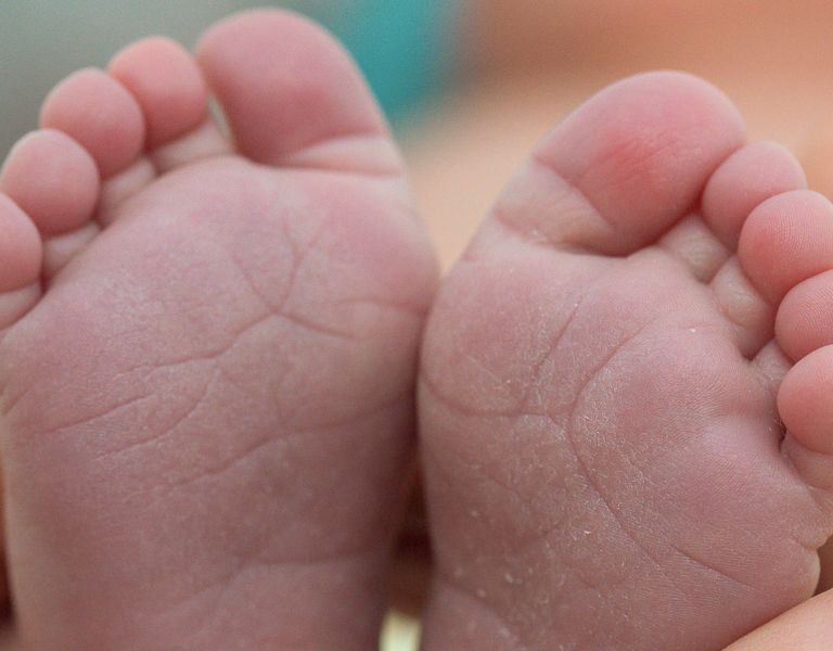 Das Bild zeigt die Füße eines Neugeborenes in Nahaufnahme