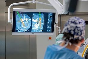 Das Bild zeigt eine Neuronavigation der Wirbelsäule.