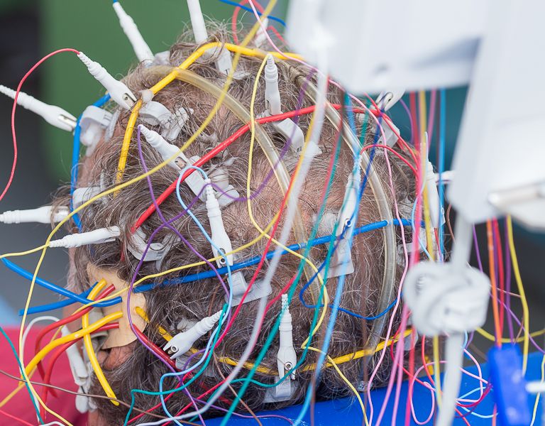 Das Bild zeigt Elektroden am Kopf