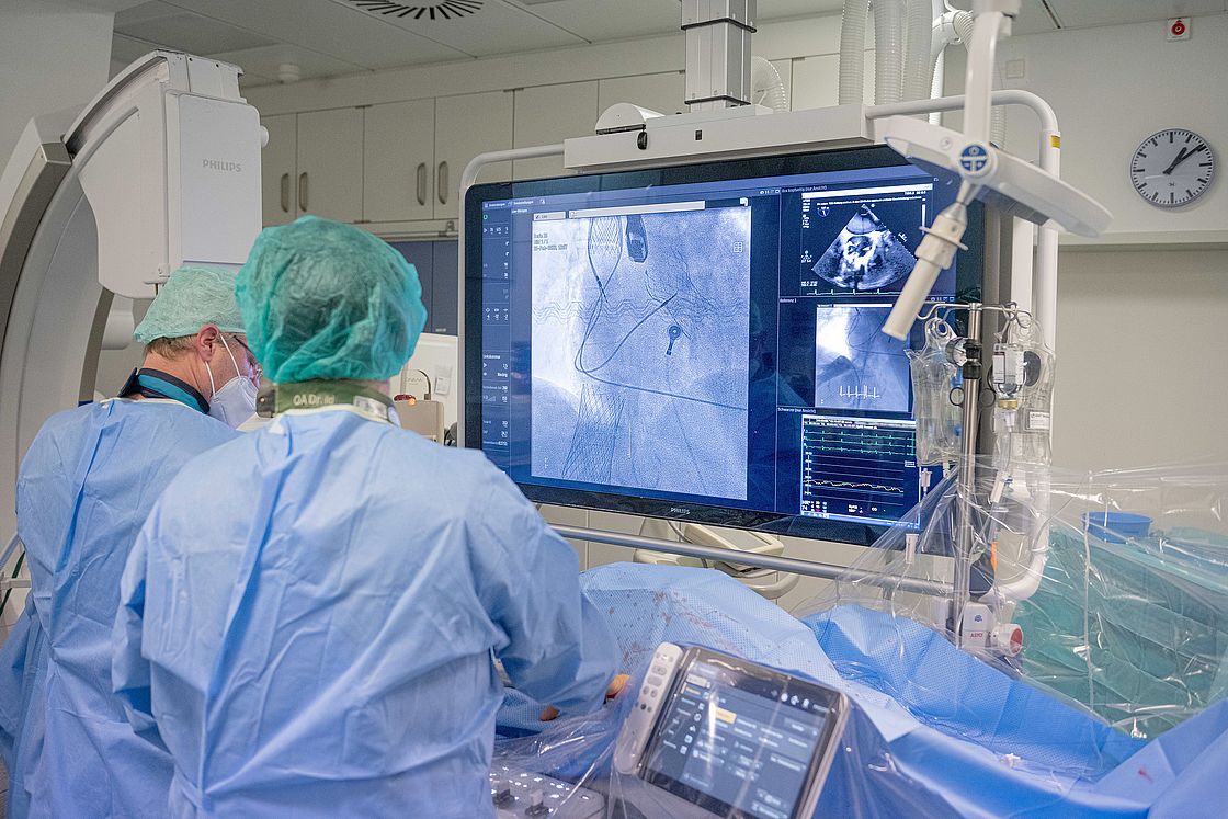 Das Bild zeigt ein Herzkatheterlabor nachdem zwei neue künstlichen Herzklappen wurden erfolgreich minimalinvasiv in die obere und untere Hohlvene eingesetzt wurden.